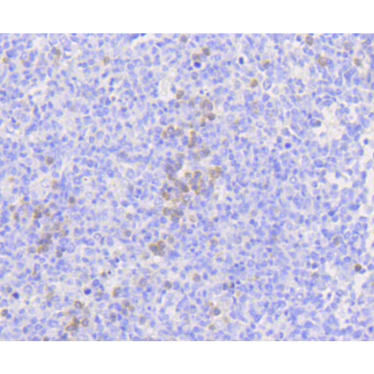 Immunohistochemistry - Anti-MLKL Antibody (A8882) - Antibodies.com