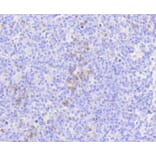 Immunohistochemistry - Anti-MLKL Antibody (A8882) - Antibodies.com