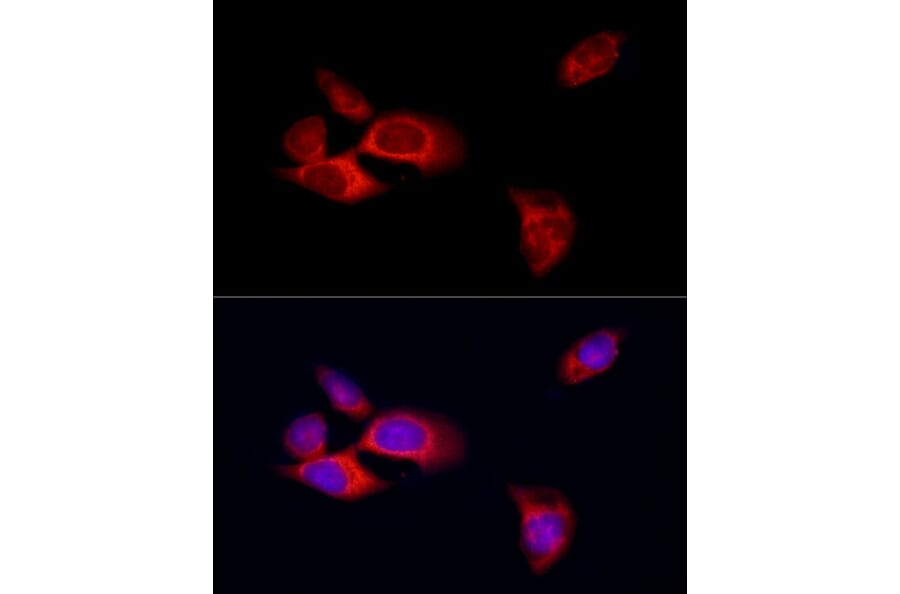 Immunofluorescence - Anti-MLKL Antibody (A8882) - Antibodies.com