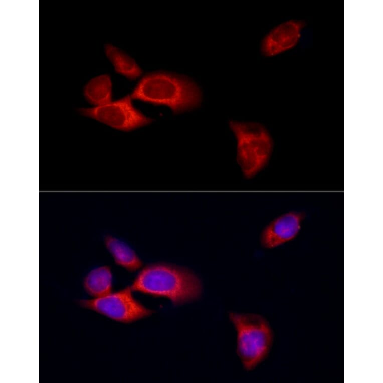 Immunofluorescence - Anti-MLKL Antibody (A8882) - Antibodies.com