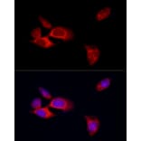 Immunofluorescence - Anti-MLKL Antibody (A8882) - Antibodies.com