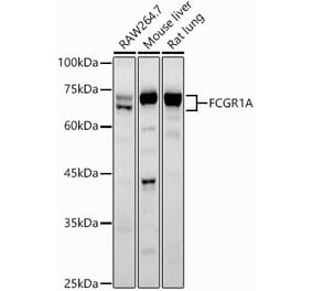 Western Blot - Anti-CD64 Antibody (A8886) - Antibodies.com