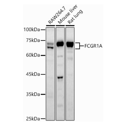 Western Blot - Anti-CD64 Antibody (A8886) - Antibodies.com