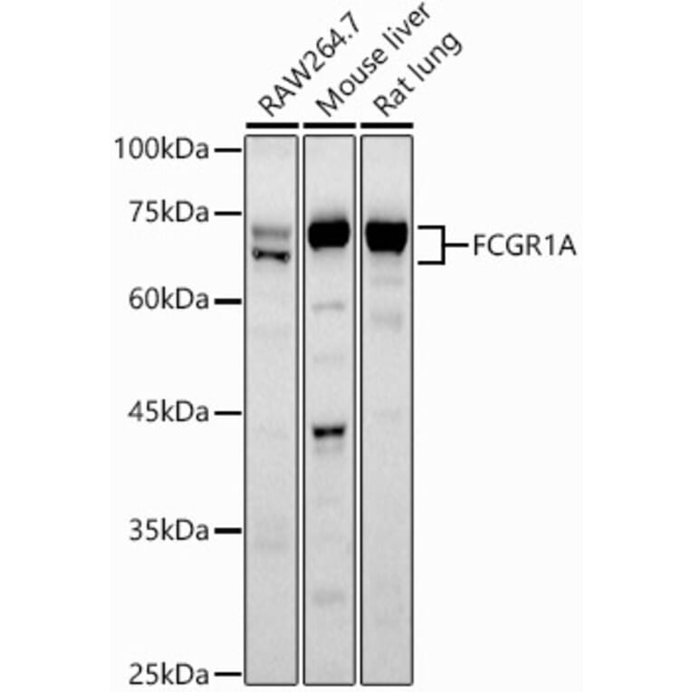 Western Blot - Anti-CD64 Antibody (A8886) - Antibodies.com