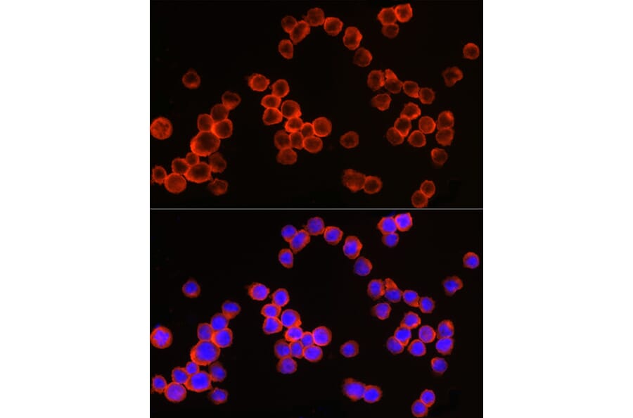 Immunofluorescence - Anti-CD64 Antibody (A8886) - Antibodies.com