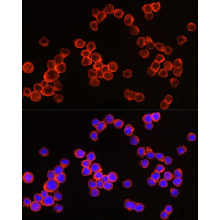 Immunofluorescence - Anti-CD64 Antibody (A8886) - Antibodies.com