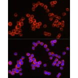 Immunofluorescence - Anti-CD64 Antibody (A8886) - Antibodies.com