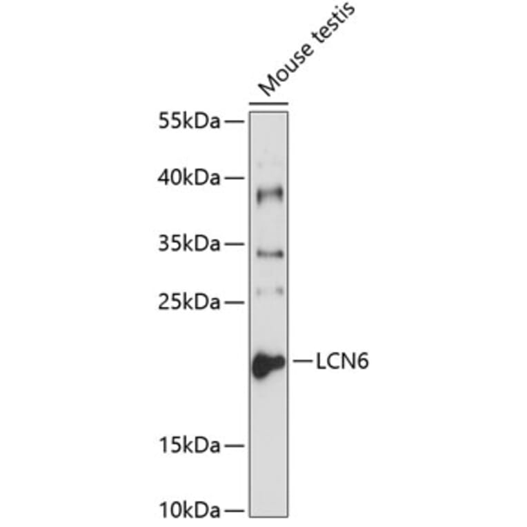 Western Blot - Anti-LCN6 Antibody (A8888) - Antibodies.com