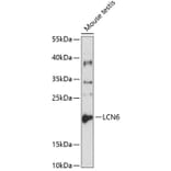 Western Blot - Anti-LCN6 Antibody (A8888) - Antibodies.com