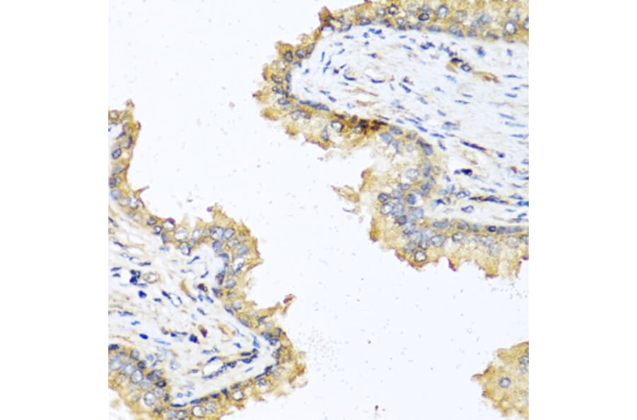 Immunohistochemistry - Anti-DEFB121 Antibody (A8889) - Antibodies.com