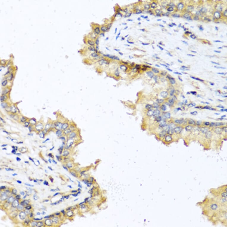 Immunohistochemistry - Anti-DEFB121 Antibody (A8889) - Antibodies.com