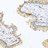 Immunohistochemistry - Anti-DEFB121 Antibody (A8889) - Antibodies.com