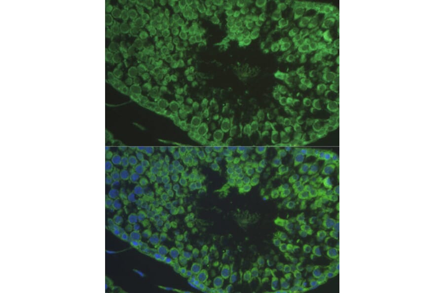 Immunofluorescence - Anti-DEFB121 Antibody (A8889) - Antibodies.com