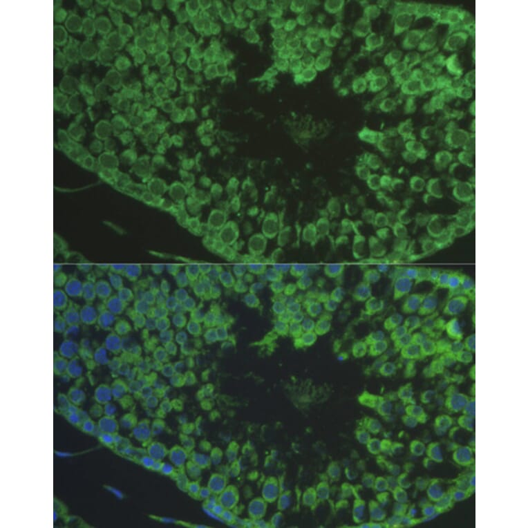 Immunofluorescence - Anti-DEFB121 Antibody (A8889) - Antibodies.com