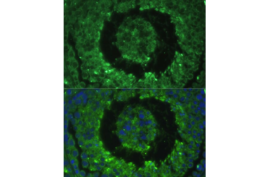 Immunofluorescence - Anti-DEFB121 Antibody (A8889) - Antibodies.com