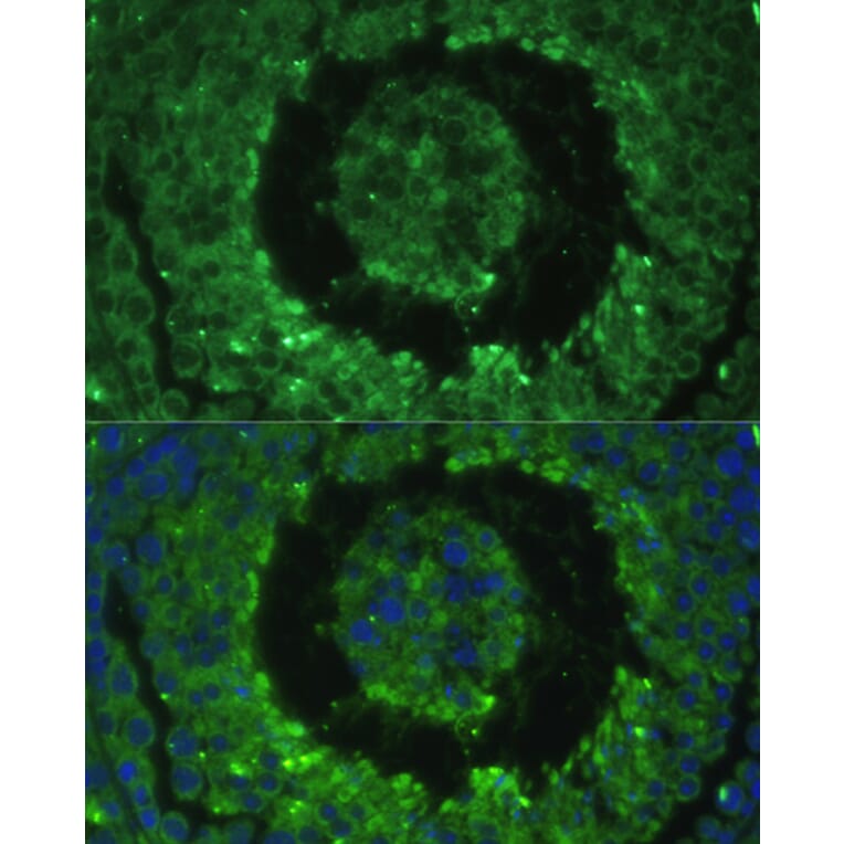 Immunofluorescence - Anti-DEFB121 Antibody (A8889) - Antibodies.com