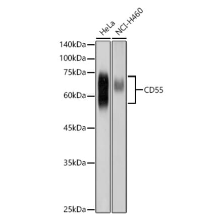 Western Blot - Anti-CD55 Antibody (A8890) - Antibodies.com
