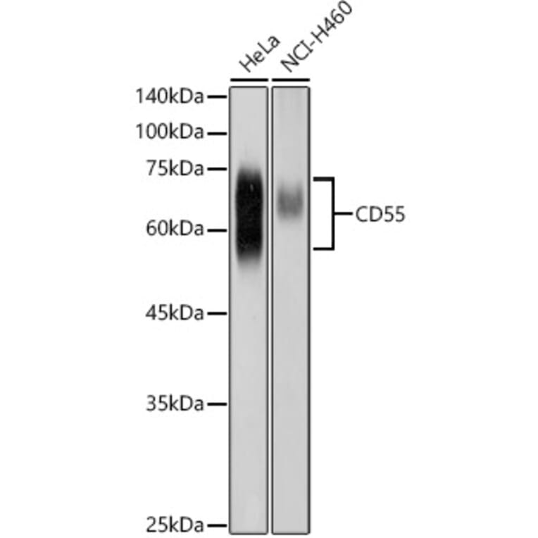 Western Blot - Anti-CD55 Antibody (A8890) - Antibodies.com