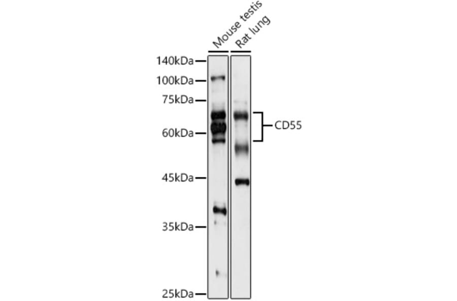Western Blot - Anti-CD55 Antibody (A8890) - Antibodies.com