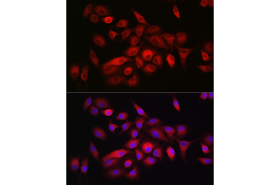 Immunofluorescence - Anti-CD55 Antibody (A8890) - Antibodies.com