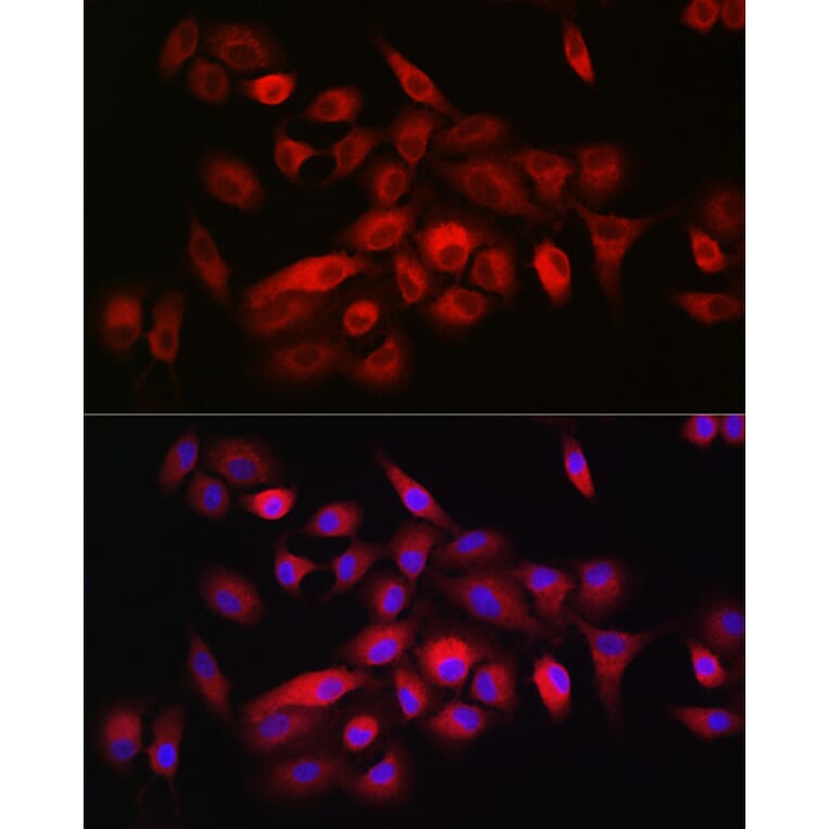 Immunofluorescence - Anti-CD55 Antibody (A8890) - Antibodies.com