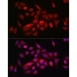 Immunofluorescence - Anti-CD55 Antibody (A8890) - Antibodies.com