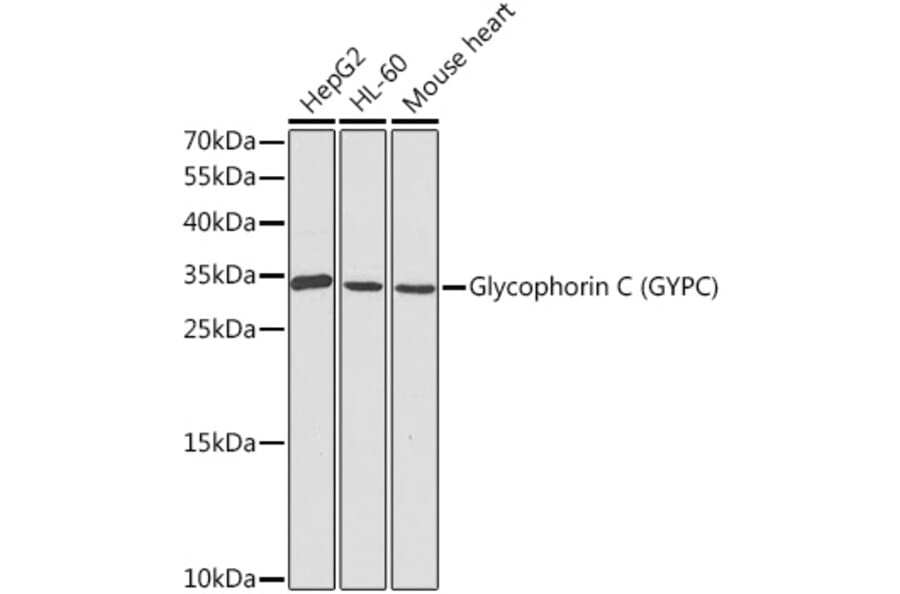 Western Blot - Anti-Glycophorin C/GPC Antibody (A8891) - Antibodies.com