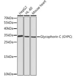 Western Blot - Anti-Glycophorin C/GPC Antibody (A8891) - Antibodies.com