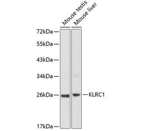 Western Blot - Anti-NKG2A Antibody (A8892) - Antibodies.com