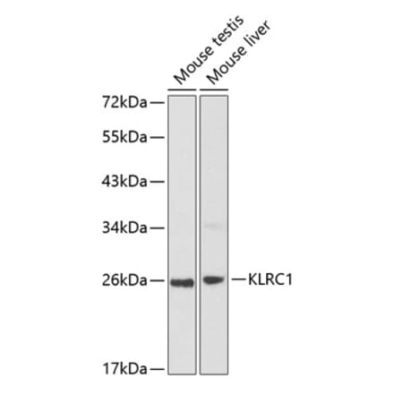 Western Blot - Anti-NKG2A Antibody (A8892) - Antibodies.com