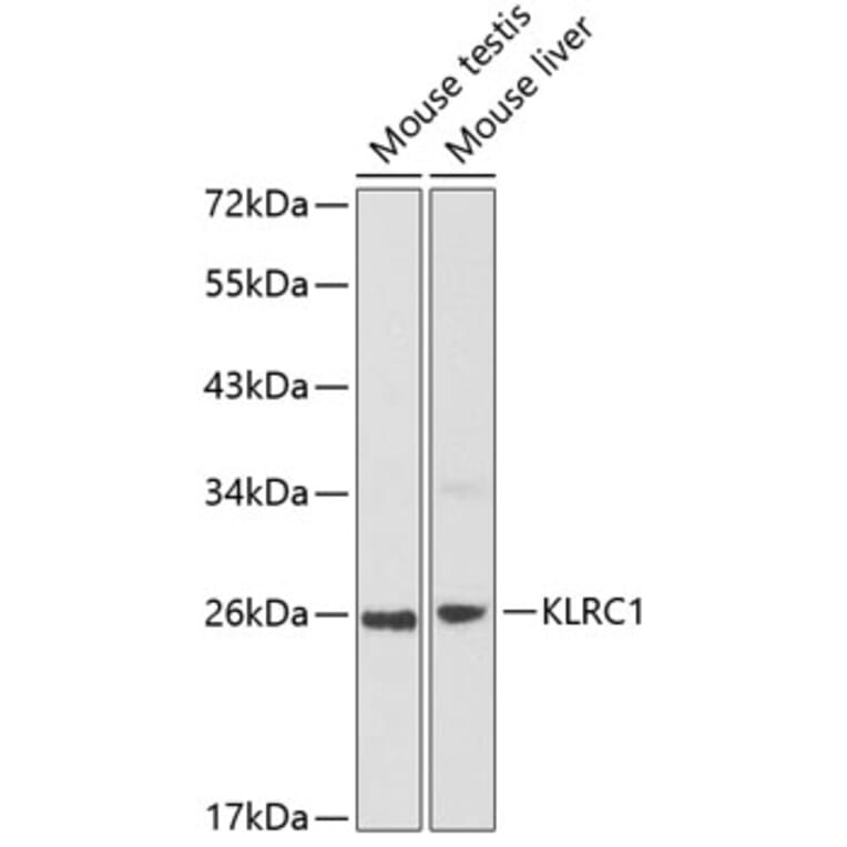 Western Blot - Anti-NKG2A Antibody (A8892) - Antibodies.com