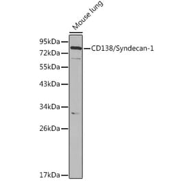Western Blot - Anti-Syndecan-1 Antibody (A8893) - Antibodies.com