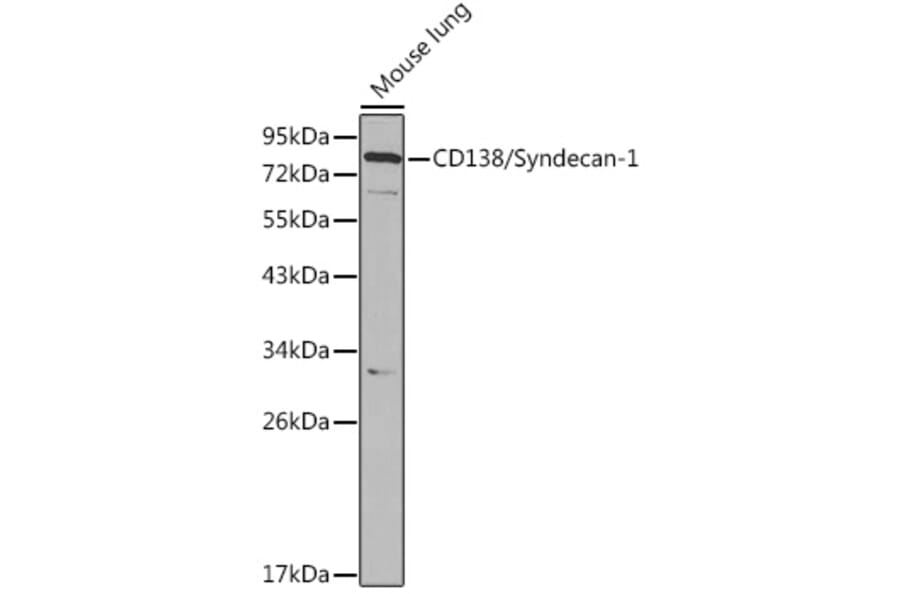 Western Blot - Anti-Syndecan-1 Antibody (A8893) - Antibodies.com