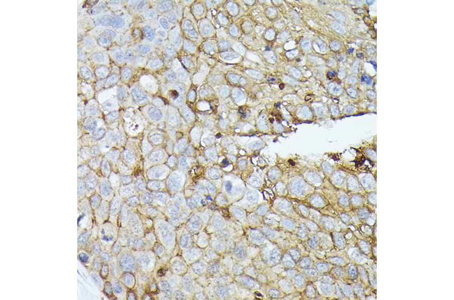Immunohistochemistry - Anti-Syndecan-1 Antibody (A8893) - Antibodies.com