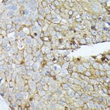 Immunohistochemistry - Anti-Syndecan-1 Antibody (A8893) - Antibodies.com