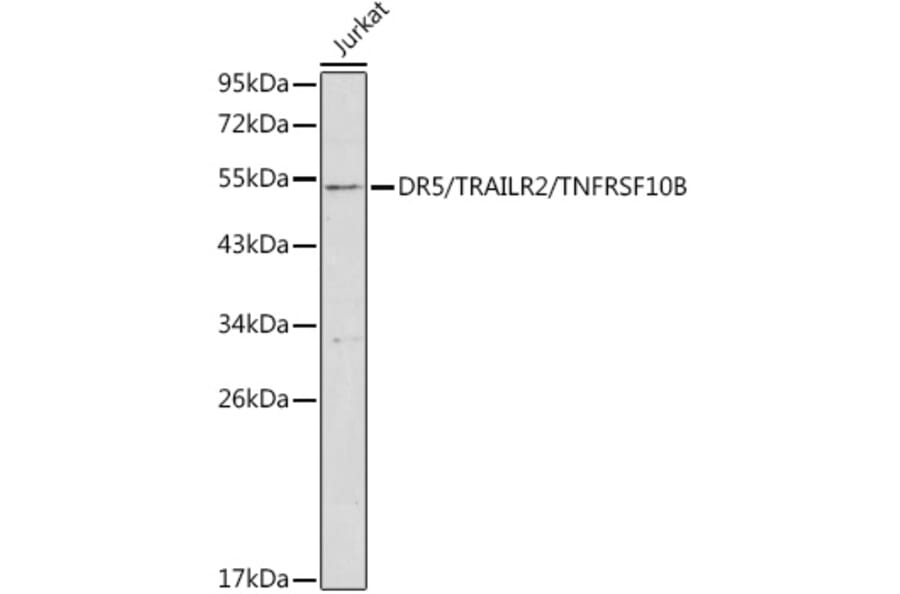 Western Blot - Anti-DR5 Antibody (A8894) - Antibodies.com