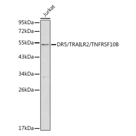 Western Blot - Anti-DR5 Antibody (A8894) - Antibodies.com