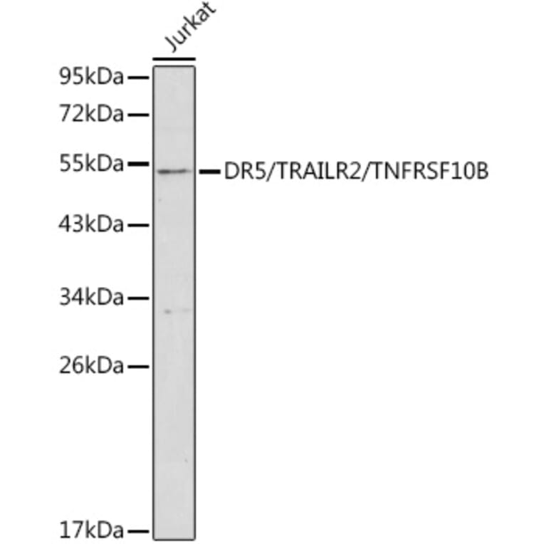 Western Blot - Anti-DR5 Antibody (A8894) - Antibodies.com