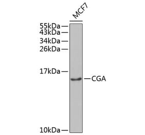 Western Blot - Anti-HCG alpha Antibody (A8895) - Antibodies.com