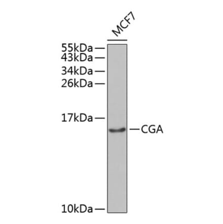 Western Blot - Anti-HCG alpha Antibody (A8895) - Antibodies.com
