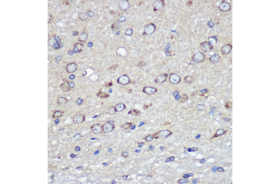 Immunohistochemistry - Anti-Junctional Adhesion Molecule 1/JAM-A Antibody (A8896) - Antibodies.com
