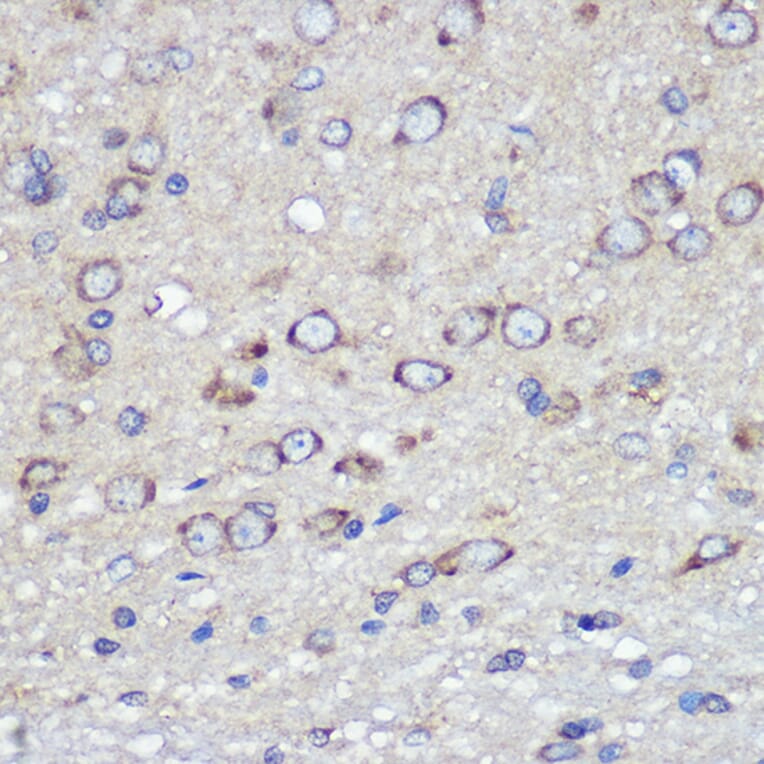 Immunohistochemistry - Anti-Junctional Adhesion Molecule 1/JAM-A Antibody (A8896) - Antibodies.com
