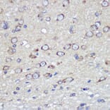 Immunohistochemistry - Anti-Junctional Adhesion Molecule 1/JAM-A Antibody (A8896) - Antibodies.com