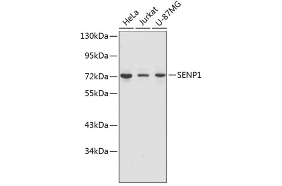 Western Blot - Anti-SENP1 Antibody (A1260) - Antibodies.com