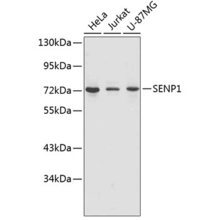 Western Blot - Anti-SENP1 Antibody (A1260) - Antibodies.com