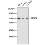 Western Blot - Anti-SENP1 Antibody (A1260) - Antibodies.com