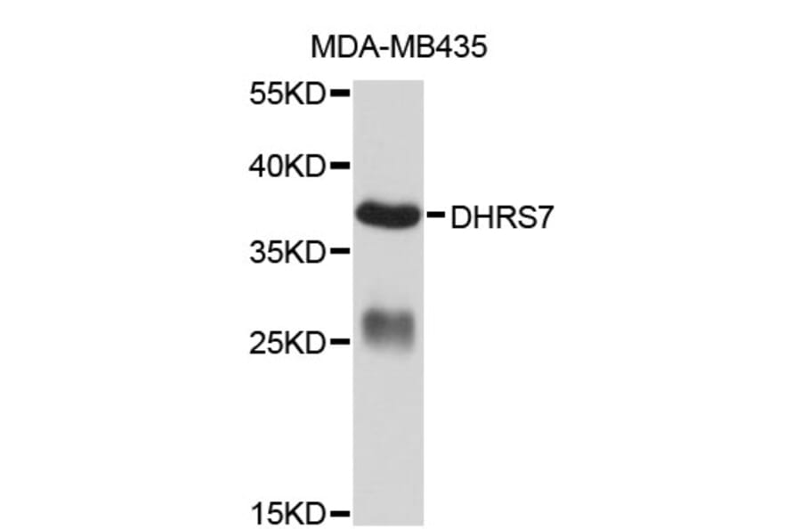 Western Blot - Anti-DHRS7 Antibody (A1274) - Antibodies.com