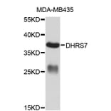Western Blot - Anti-DHRS7 Antibody (A1274) - Antibodies.com