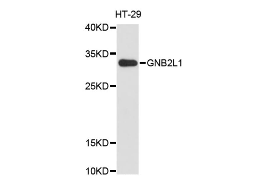 Western Blot - Anti-GNB2L1 Antibody (A1275) - Antibodies.com