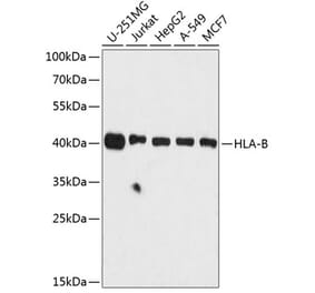 Western Blot - Anti-HLA Class 1 ABC Antibody (A8902) - Antibodies.com